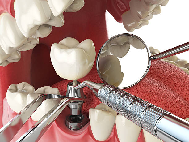 Best Weekend Emergency Dentist in Lake Worth, TX