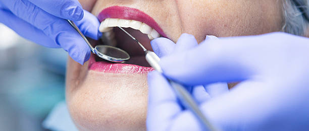 Best Emergency Tooth Extraction in Lake Worth, TX